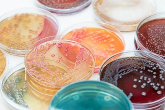bacteria growth pathogens food safety pathogen control